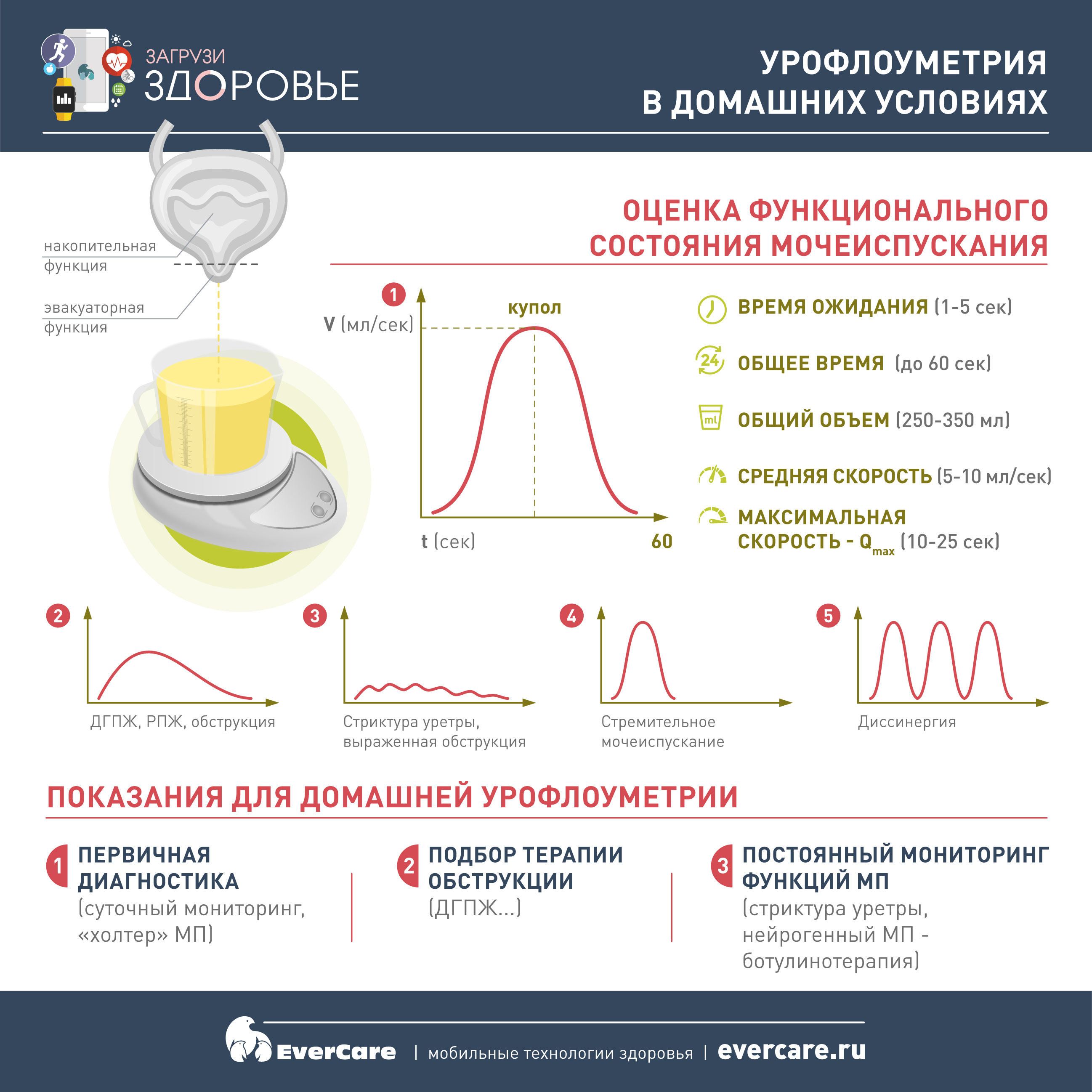 Как развить скорость ног в футболе.